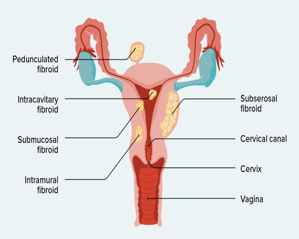 Infertility Treatment Specialist and Gynecologist in Kolkata